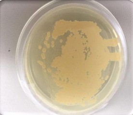 含油土壤生物生态复合修复技术